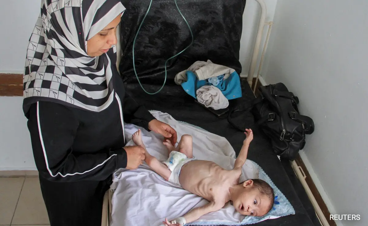 Children Starve As Millions Of Gaza Inhabitants Face Famine Threat